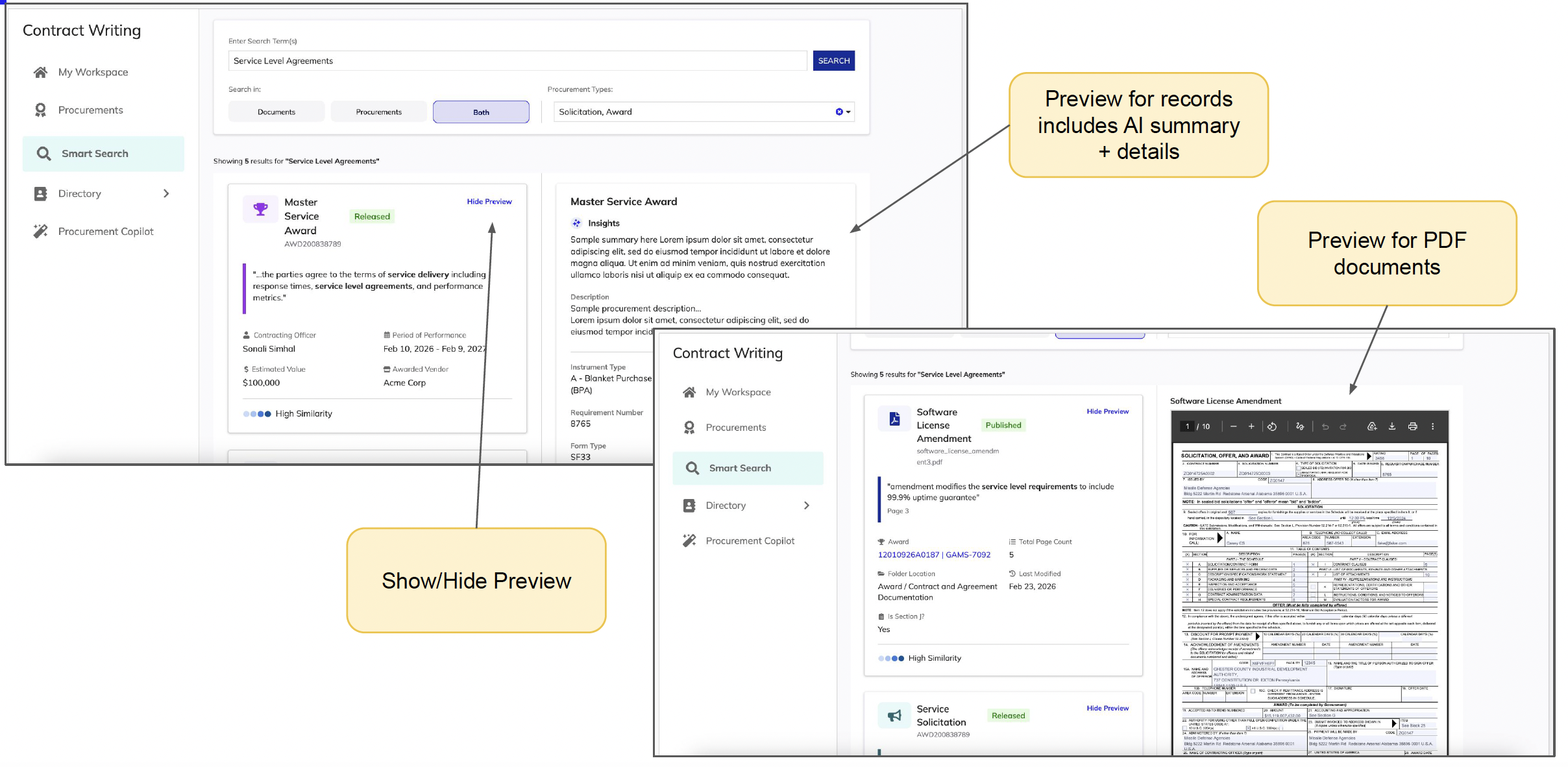 Smart Search preview system showing record previews with AI summaries, PDF document inline viewers, and the Show/Hide Preview toggle